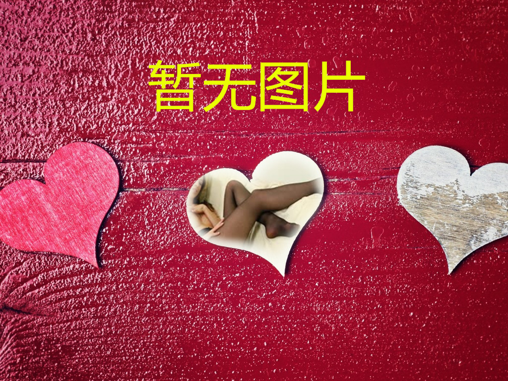 SBVD日本系列378